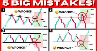 5 BIGGEST Trading Mistakes That Will Make You Lose Forever (Painful To See.....)